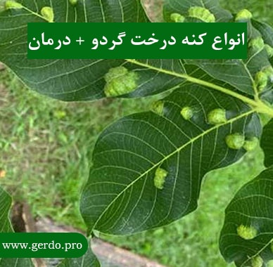 کنه گال کیسه ای
